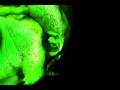 Golgi Apparatus - an animatic