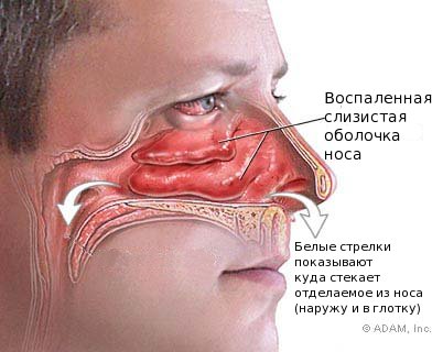 120812_running_nose.jpg